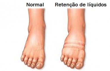 Como combater a retenção de líquidos?