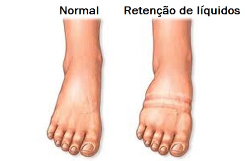 A retenção de líquidos: como combatê-la? - Melhor com Saúde