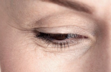 Como atenuar as rugas debaixo dos olhos?