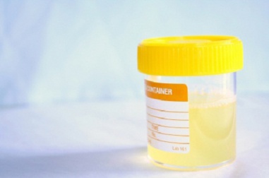 Como prevenir naturalmente as infecções urinárias?