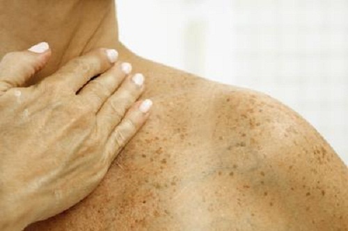 Como frear os sinais da velhice? Como frear os sinais da velhice?