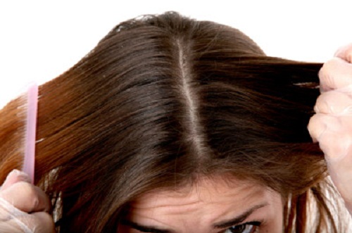 cabelo oleoso