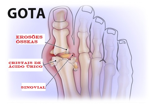 gota