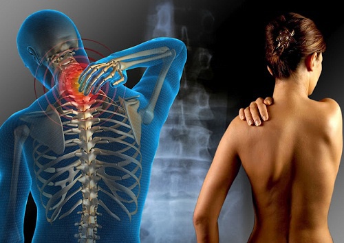 Como tratar a fibromialgia com ervas