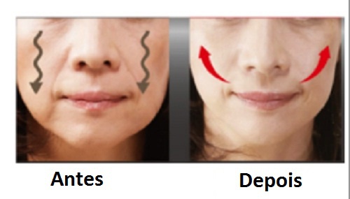 Bochechas caídas? Levante com estas 4 dicas