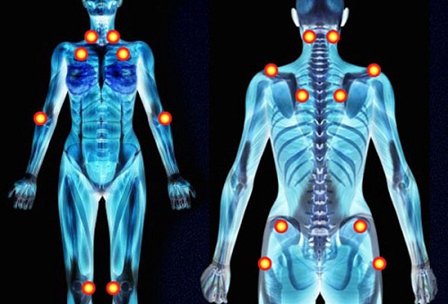 Pontos das dores nos braços e no corpo