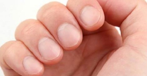 8 sinais de advertência na saúde que suas unhas podem estar revelando 8 sinais de advertência na saúde que suas unhas podem estar revelando