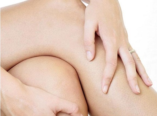 Desgaste nos joelhos