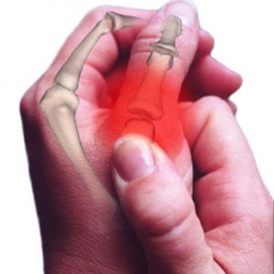 Como aliviar os sintomas da artrose