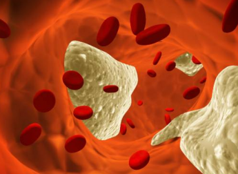 7 mitos que você deveria saber sobre o colesterol