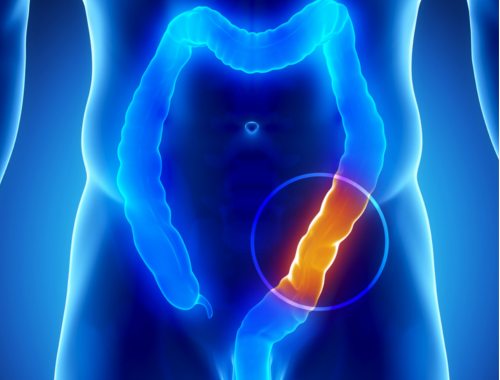 Efeitos da semente de linhaça no intestino