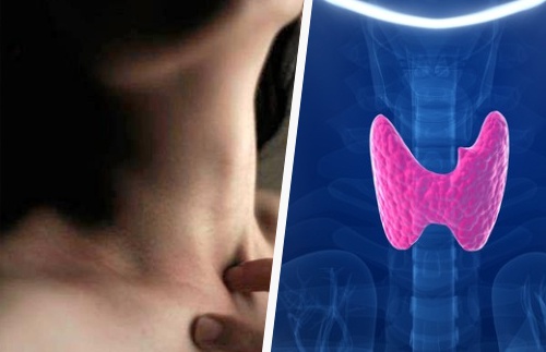 Alimentos que ajudam a regular a tireoide