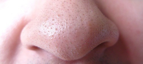 Acne e cravos: 3 formas através das quais o chá verde pode ajudar
