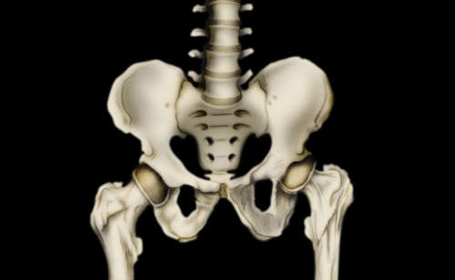 Sintomas do desgaste dos quadris e sua prevenção Sintomas do desgaste dos quadris e sua prevenção