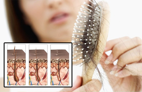 Por que o seu cabelo está caindo? Contamos aqui! Por que o seu cabelo está caindo? Contamos aqui!