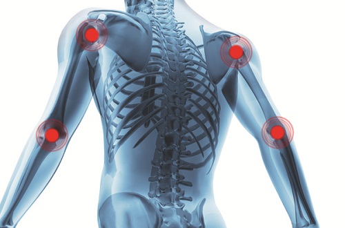Artrite-e-dor-articular