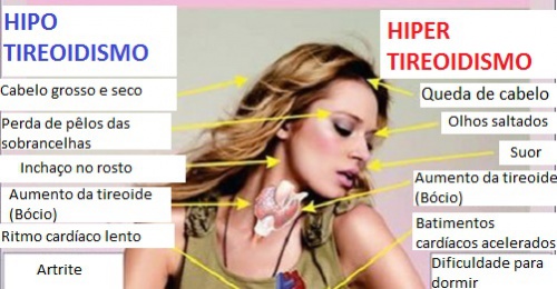 Alimentos que ajudam a regular a tireoide