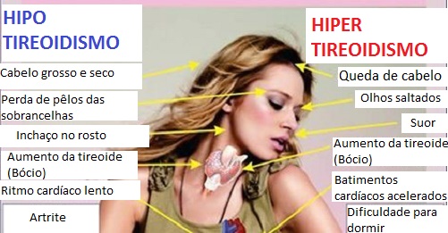 Alimentos que ajudam a regular a tireoide Alimentos que ajudam a regular a tireoide