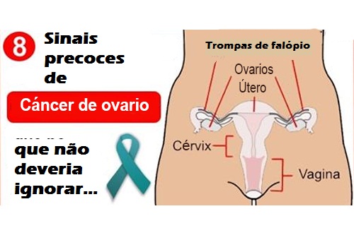 8 sinais recentes de câncer de ovário que não devem ser ignorados 8 sinais recentes de câncer de ovário que não devem ser ignorados