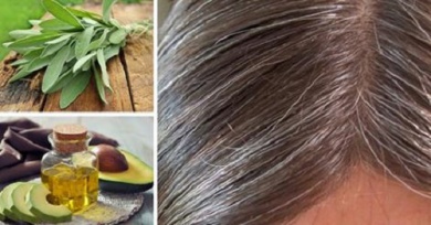 Cabelo branco? Causa e remédios naturais