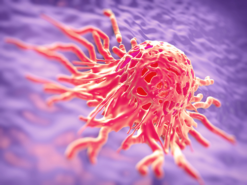 Células do câncer de mama