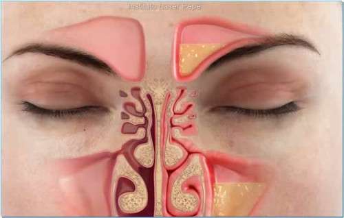 Como eliminar a congestão nasal rapidamente