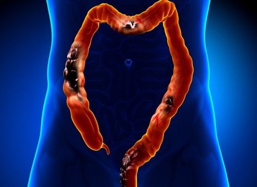 dor abdominal do lado esquerdo