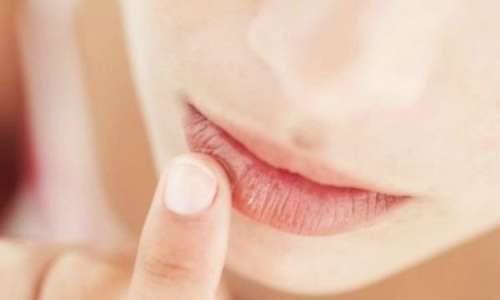 Vick Vaporub pode ser utilizado em lábios ressecados.