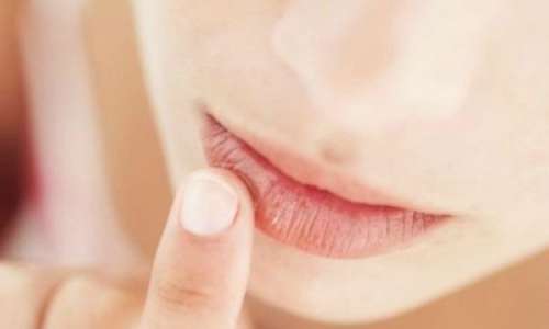 O uso de protetor labial pode ser considerado um remédio caseiro para herpes