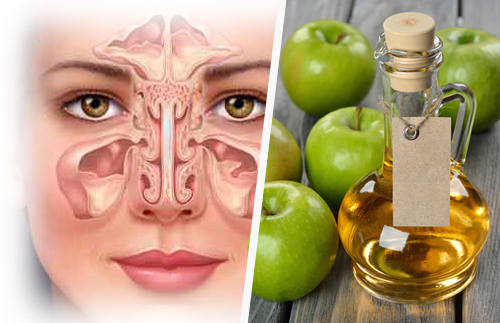 Remédios naturais para combater a sinusite