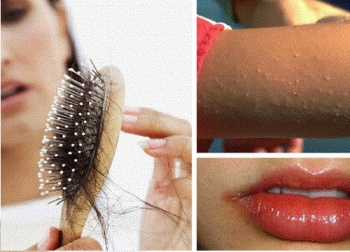 Sinais estranhos que indicam uma deficiência de vitaminas