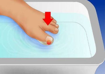 Como tratar corretamente as unhas encravadas