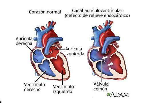 7 sintomas de um sopro cardíaco: conheça-os!