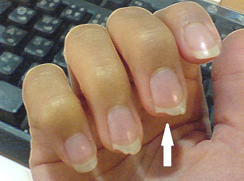 Unhas