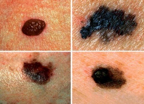 alterações na pele pode ser um dos sinais que seu corpo envia que algo não vai bem