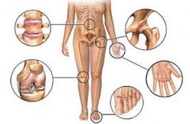5 anti-inflamatórios naturais para tratar a dor articular