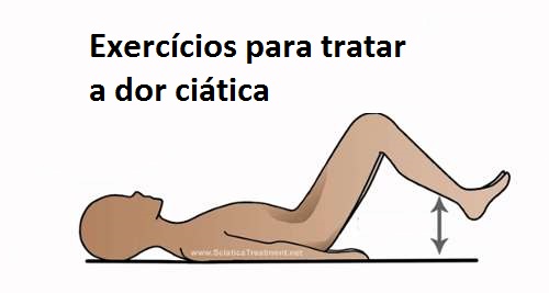 Os melhores exercícios para aliviar a dor do nervo ciático Os melhores exercícios para aliviar a dor do nervo ciático