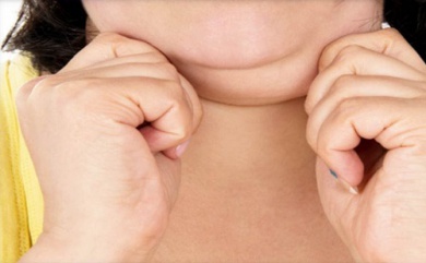 6 dicas imprescindíveis para diminuir a papada