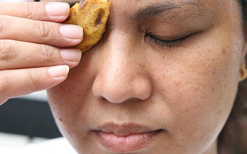 Casca de banana para eliminar verrugas