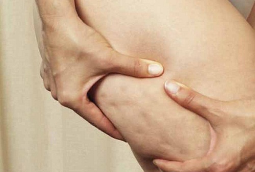 Óleo de coco, limão e toranja, um remédio natural contra a celulite