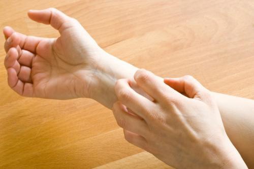 Mulher coçando o braço por causa de dermatite