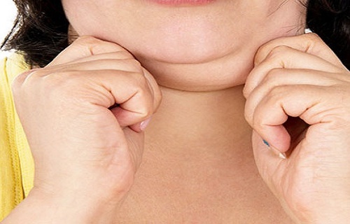 3 formas de diminuir a papada e tonificar o pescoço 3 formas de diminuir a papada e tonificar o pescoço