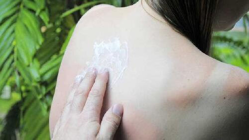 5 conselhos para evitar que as manchas solares na pele