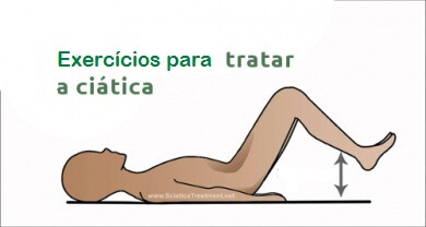 Exercícios físicos para tratar a dor ciática