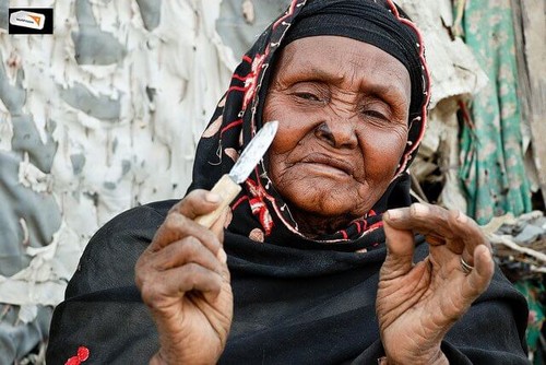 A mutilação genital ainda ocorre em vários países da África e da Ásia