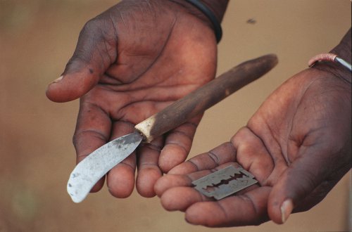 Dados sobre a mutilação genital