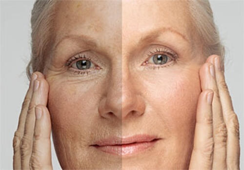 Quantos anos a sua pele tem? Aprenda a “rejuvenescê-la” Quantos anos a sua pele tem? Aprenda a “rejuvenescê-la”