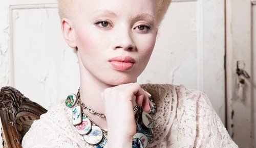 Albinismo: o comovente caso da modelo Thando Hopa