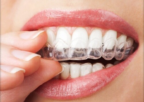 4 técnicas para não ranger os dentes 4 técnicas para não ranger os dentes