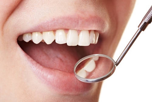 Como eliminar a placa bacteriana de maneira simples em casa